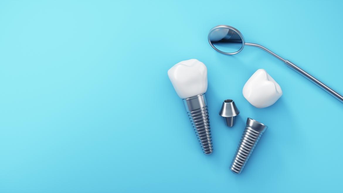 Implantes Dental Unitario